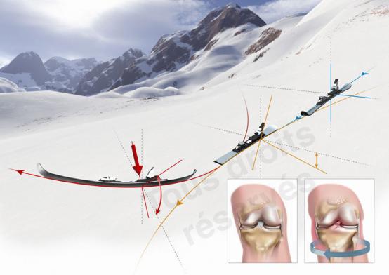 Ski parabolique avantages - Science & Vie