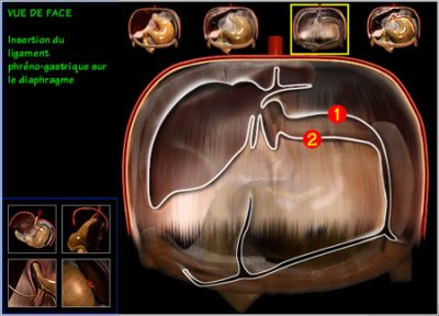 Digestive surgery - phrenogastric ligament