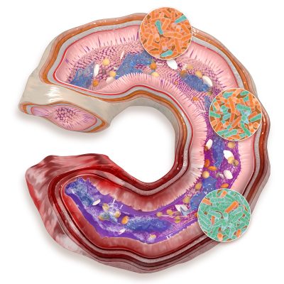 Phileo — hen intestine, clostridium pathology