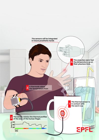 Amputee Feels with Bionic Hand — EPFL
