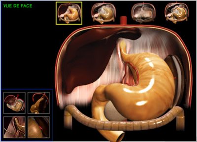 digestive surgery, front view