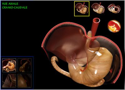 digestive surgery, axial view