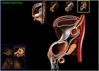 Medical CD-ROM on digestive surgery - sagittal section
