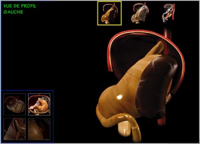 digestive surgery, side view 2
