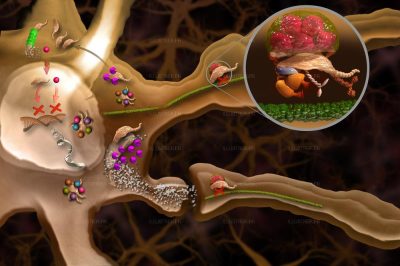 Pour La Science. Huntington's disease 2