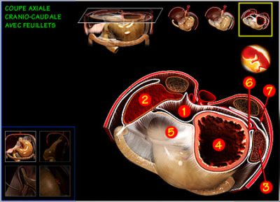 Medical CD-ROM on digestive surgery - craniocaudal section