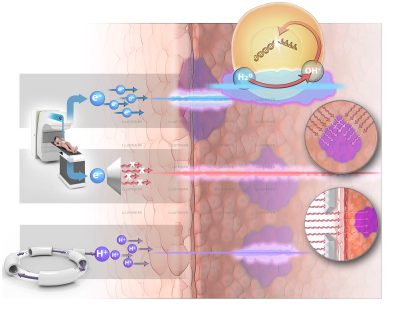 Science & Vie cancer, radiation therapy