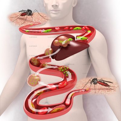 Science et Vie - Malaria
