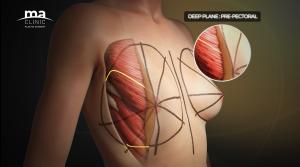 MA Clinic Plastic Surgery