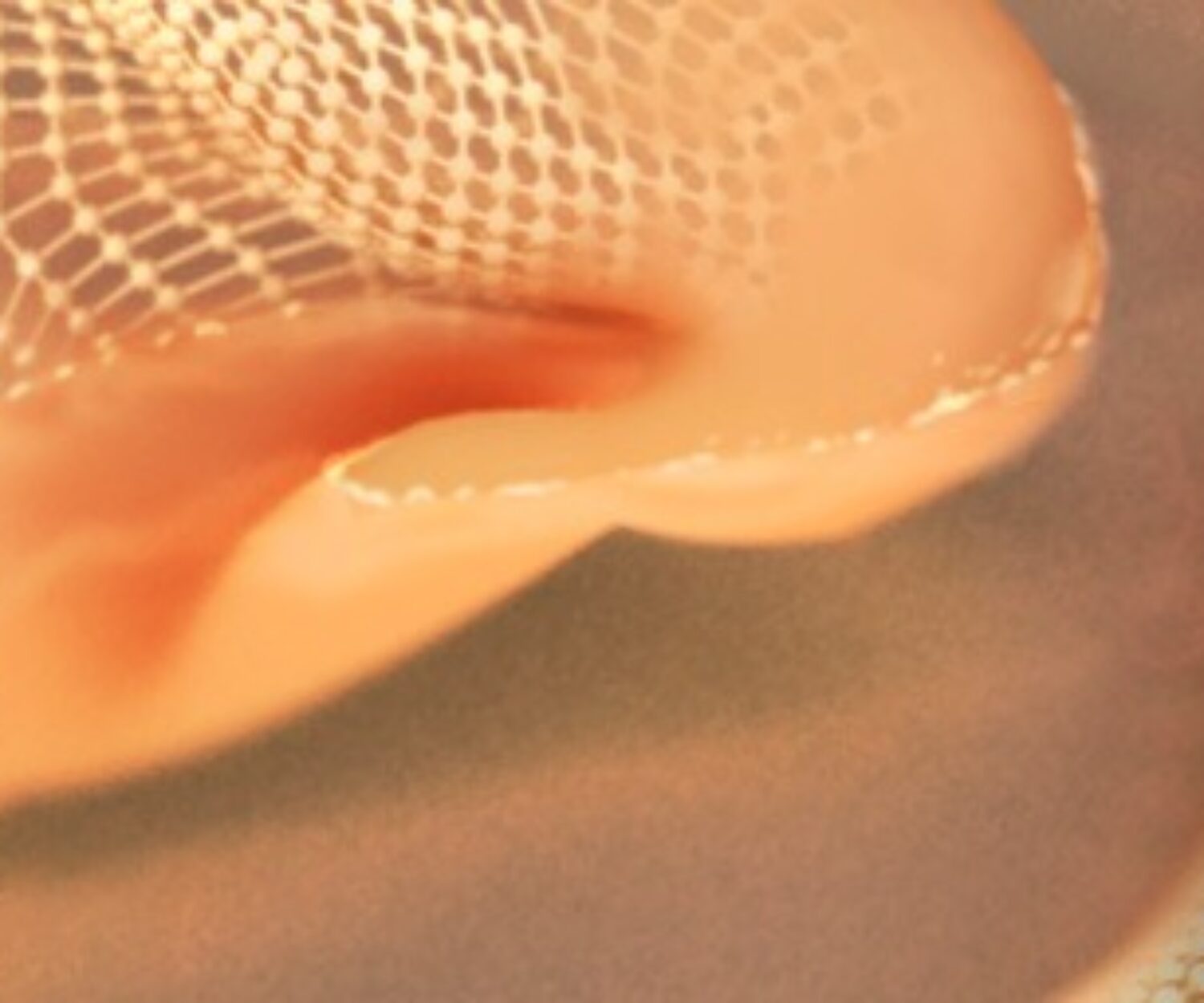 Impression médicale 3D