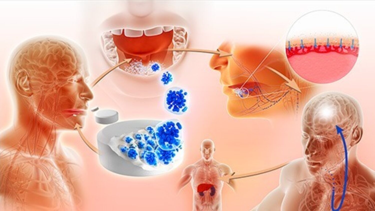 Illustration médicale