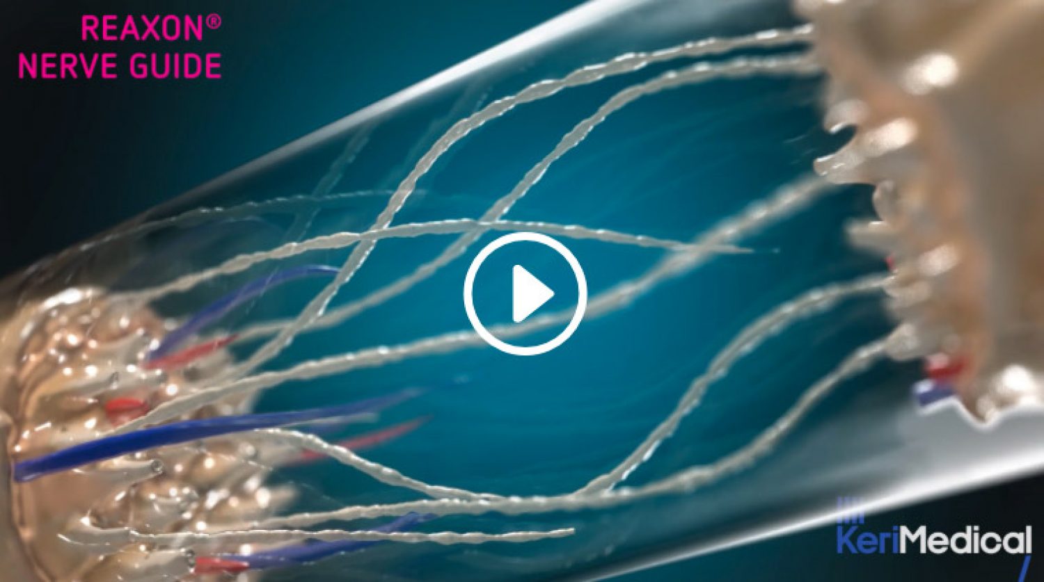 Film d'animation médical sur la reconstruction des nerfs