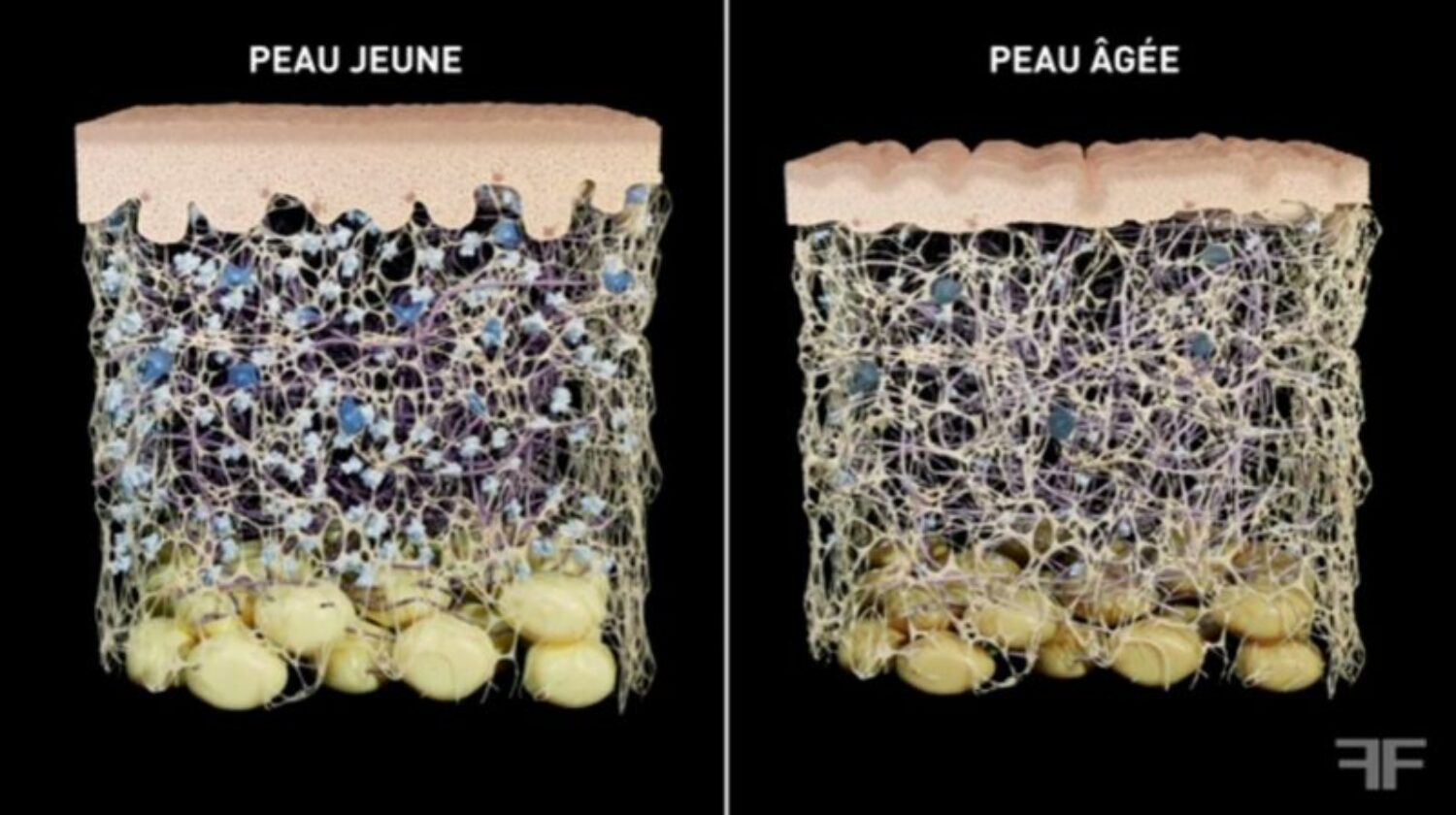 Film d'animation médical sur le vieillissement de la peau
