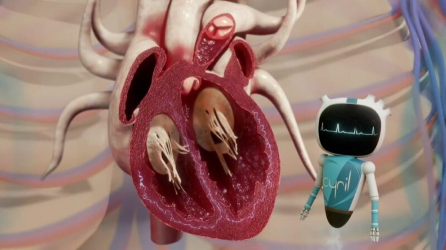 Film d'animation médical sur un logiciel d'assistance aux chirurgiens