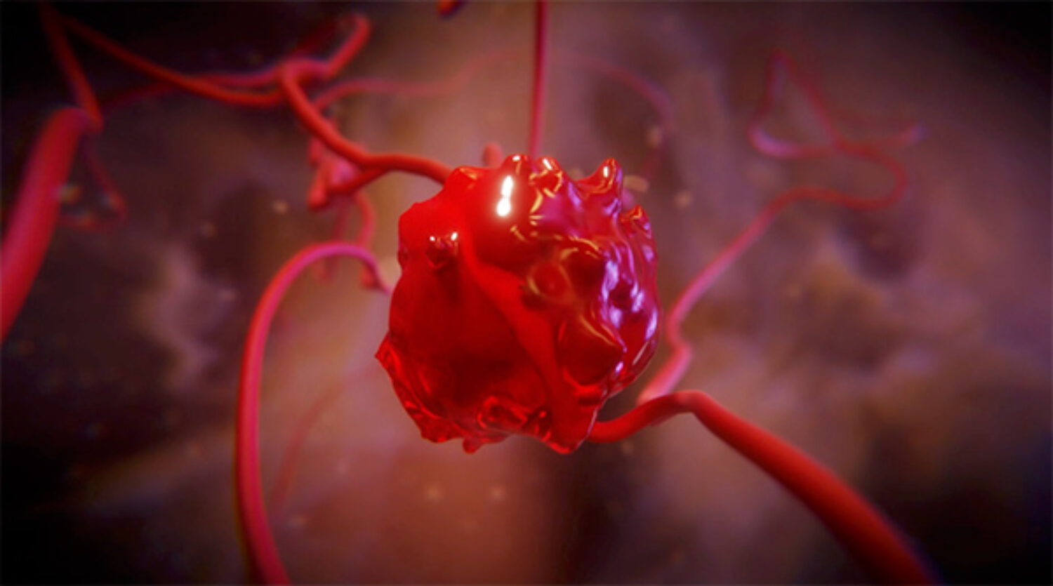 Animation 3D hémorragie