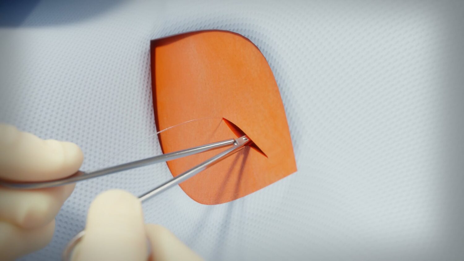 Animation 3D chirurgicale